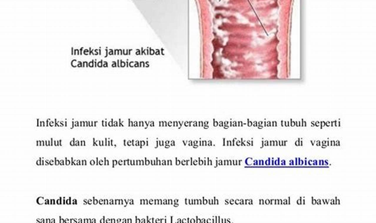 Cara Mengatasi Vagina Gatal